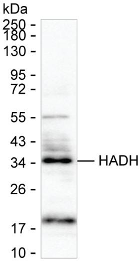 HADH